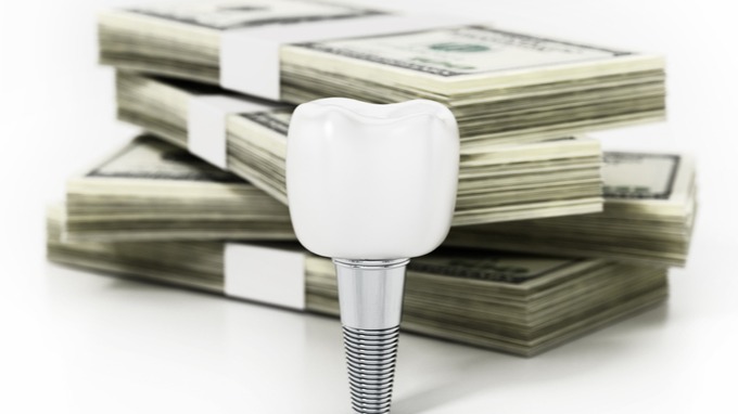 How to save on dental implant treatment