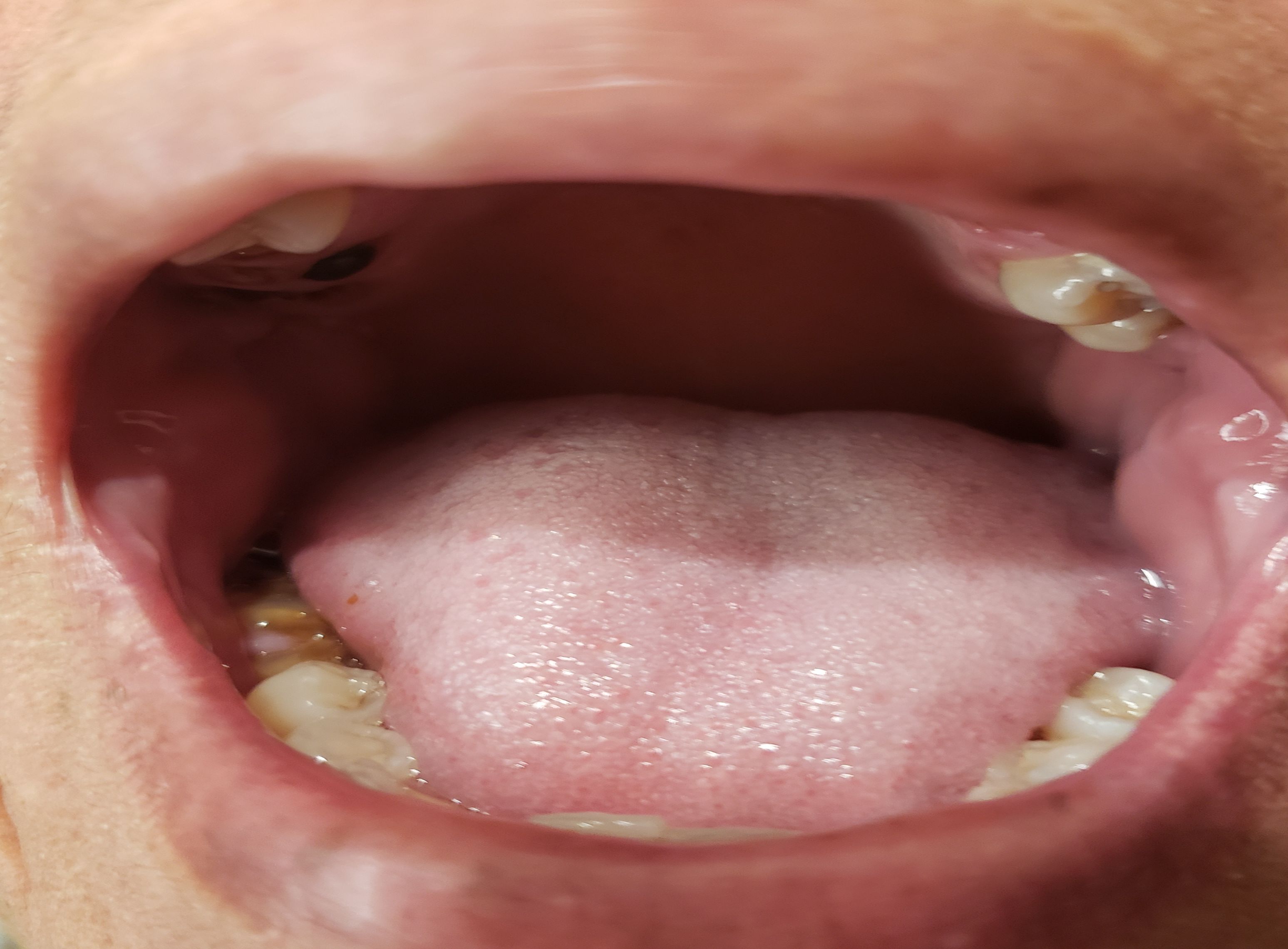 mouth open