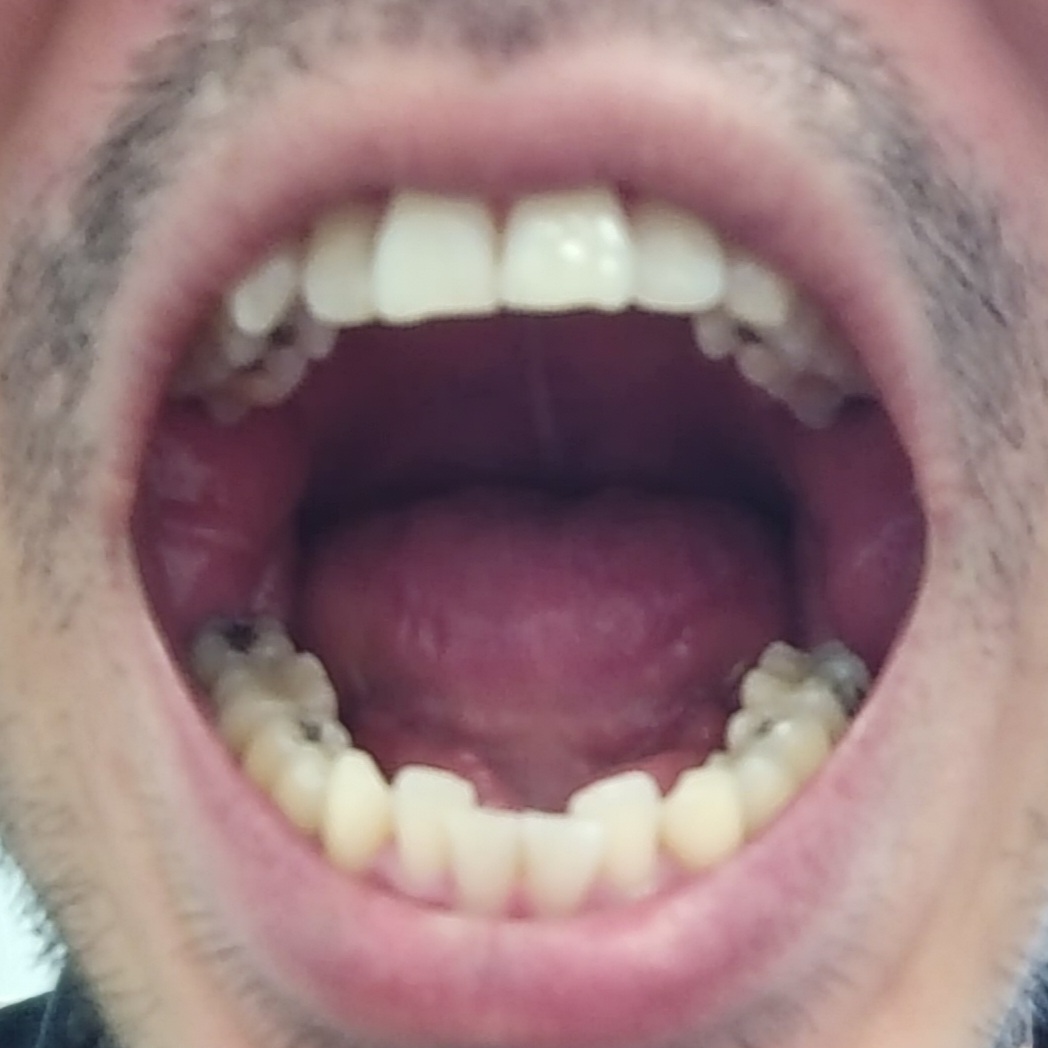 mouth open